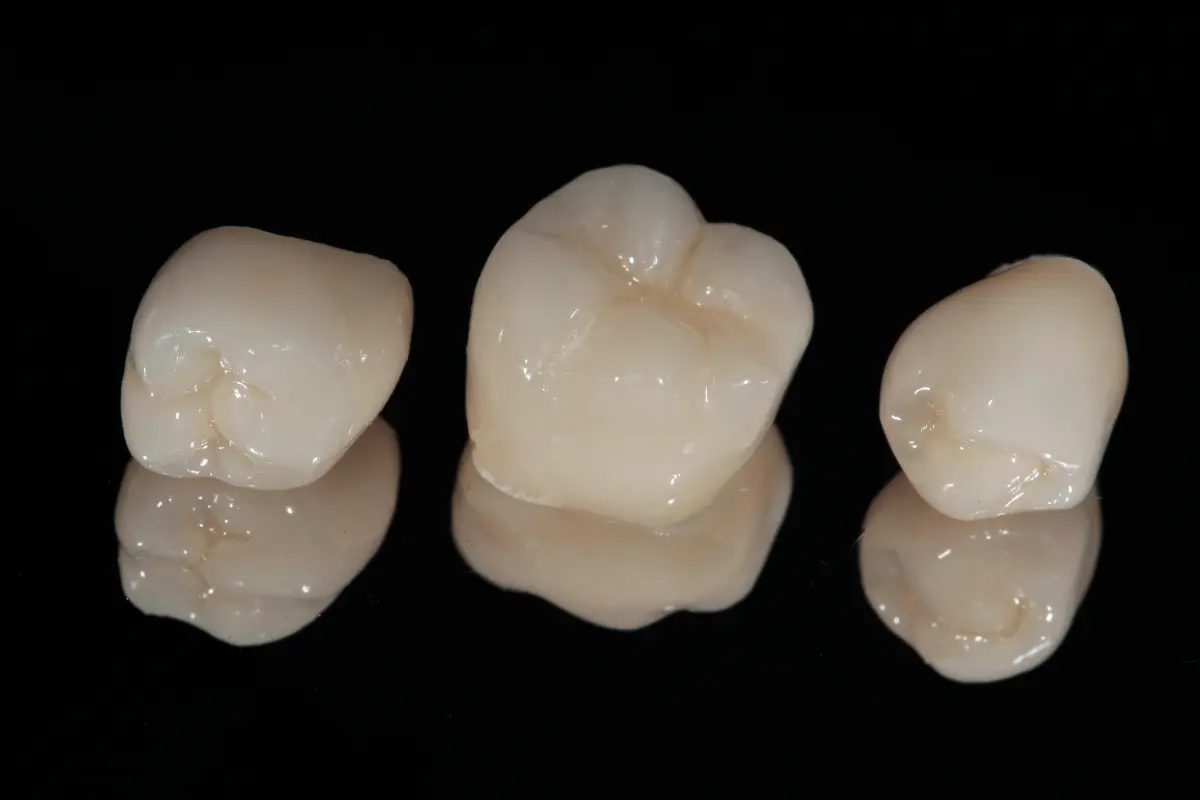 Dental crowns at Face Dental, Coventry