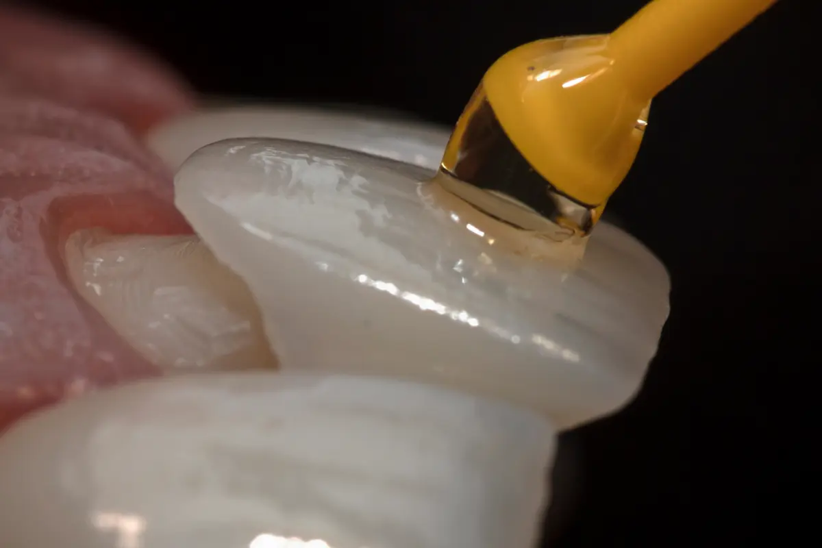 Veneers consultation at Face Dental