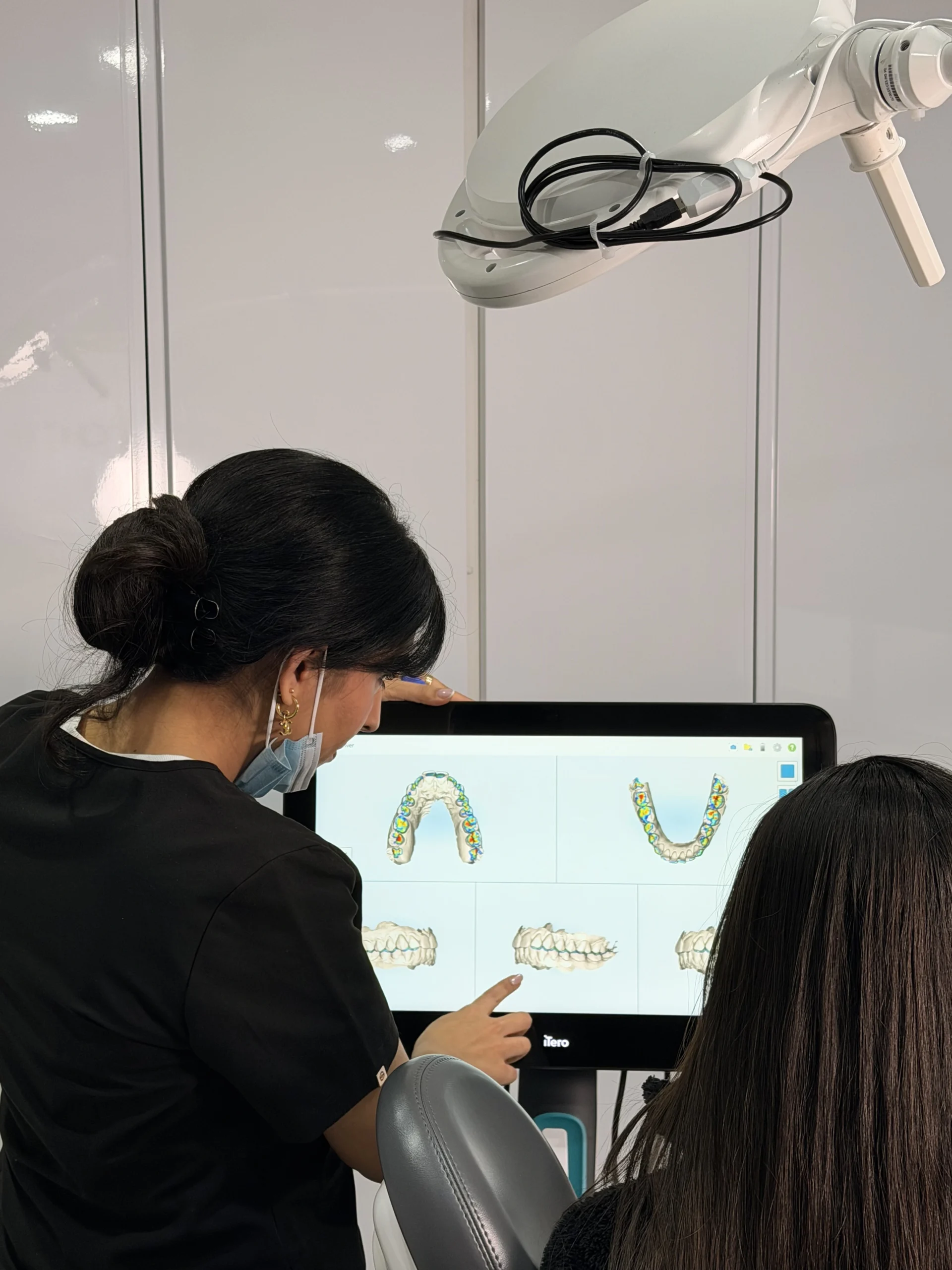 iTero scan