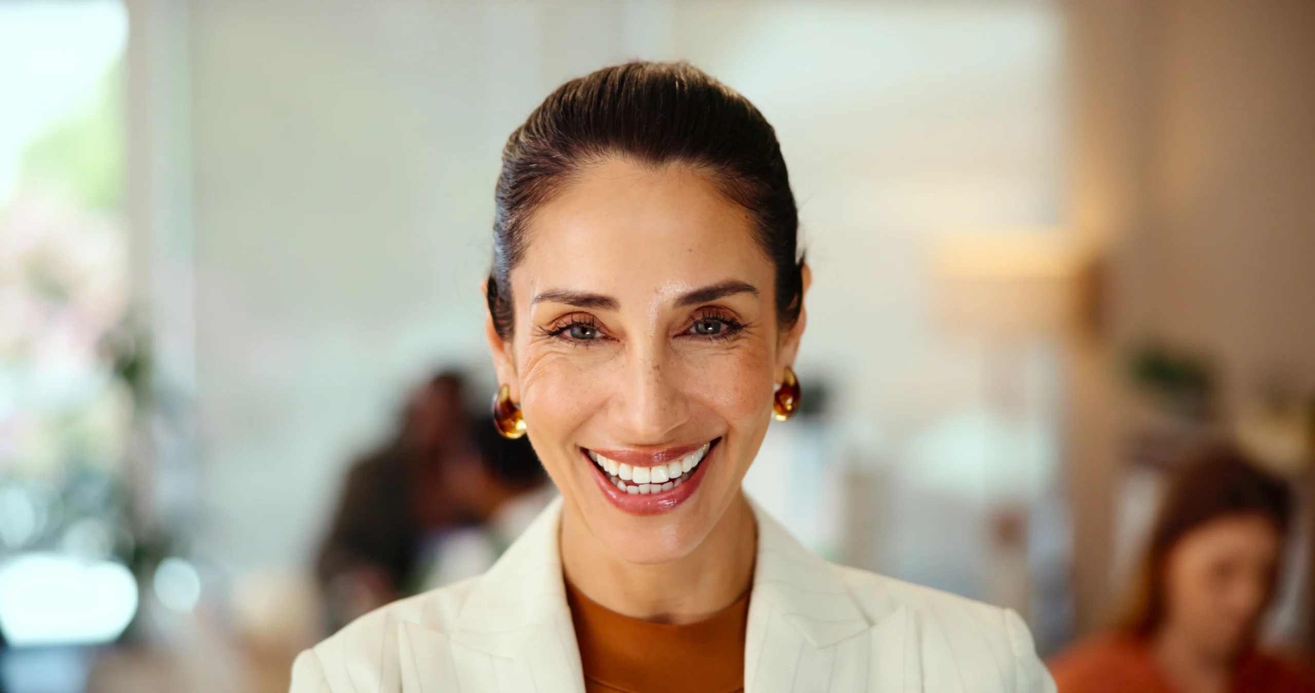 Teeth whitening results at Face Dental, Coventry