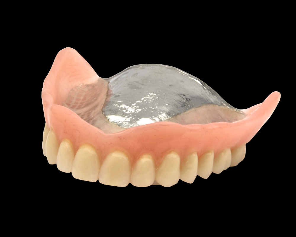Full metal denture