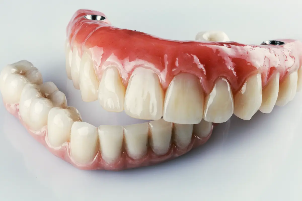 Implant-retained dentures at Face Dental, Coventry