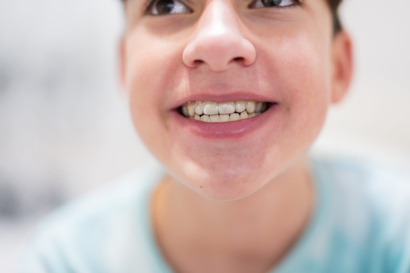 Invisalign clear aligners