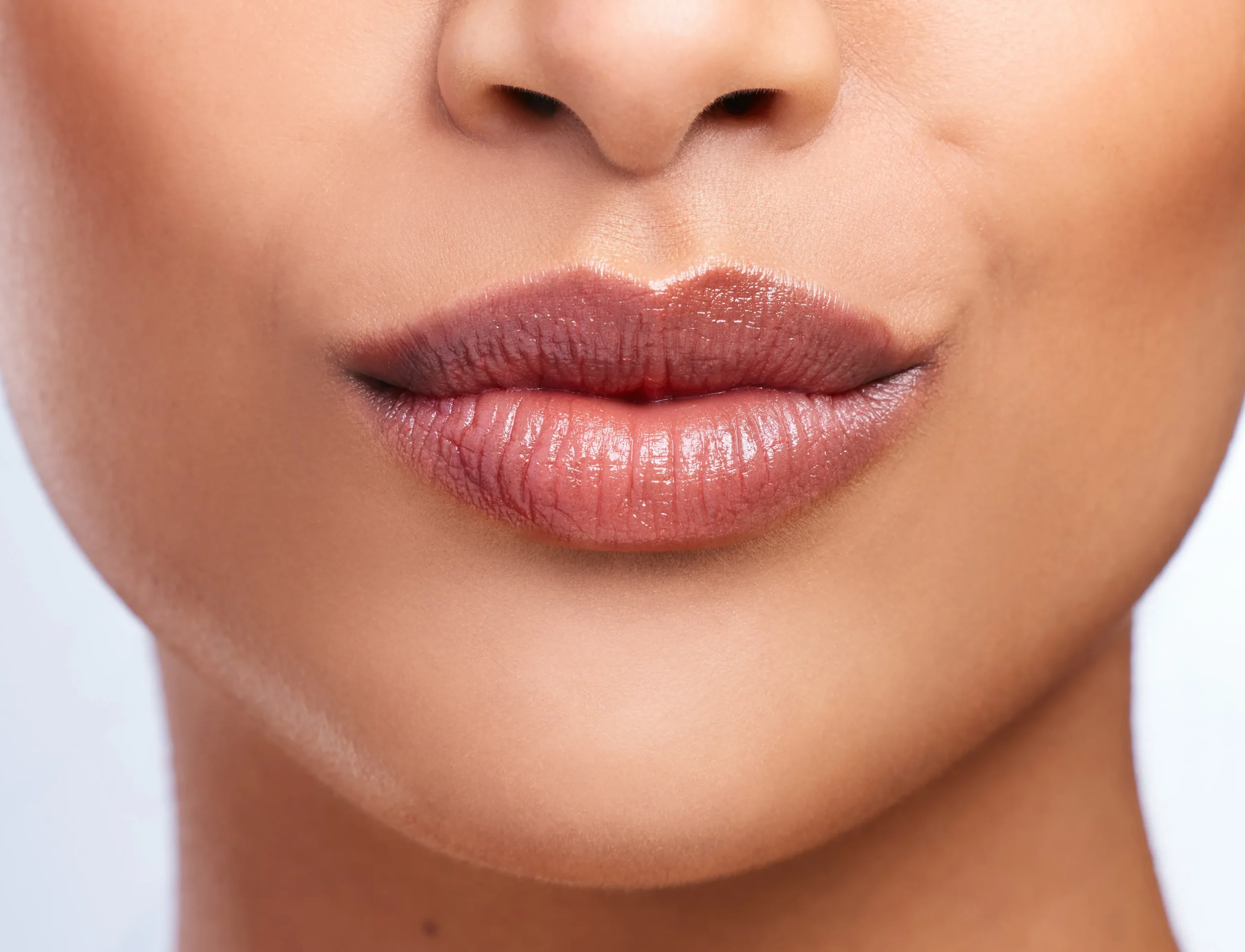 Lip filler treatment at Face Dental Coventry