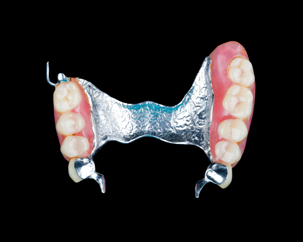 Partial metal denture